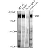 Western Blot - Anti-LRP5 Antibody [ARC52451] (A329575) - Antibodies.com