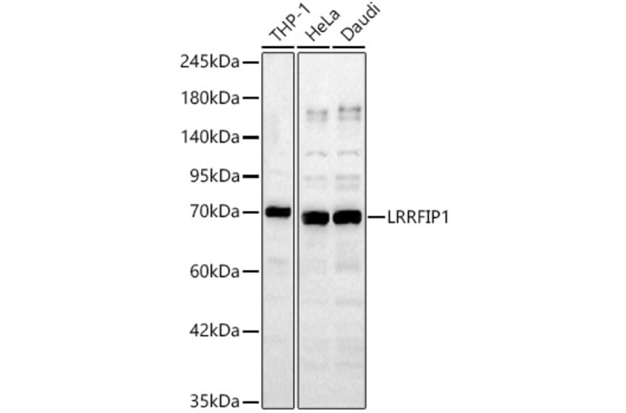 Western Blot - Anti-LRRFIP1 Antibody (A329576) - Antibodies.com