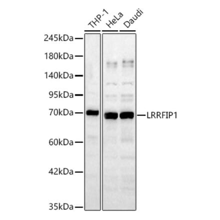 Western Blot - Anti-LRRFIP1 Antibody (A329576) - Antibodies.com