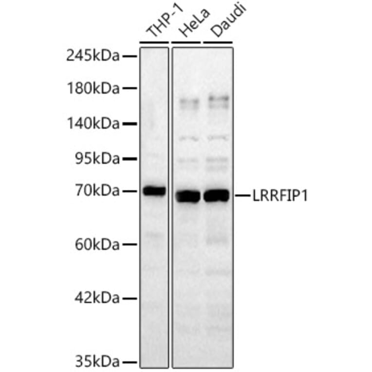 Western Blot - Anti-LRRFIP1 Antibody (A329576) - Antibodies.com