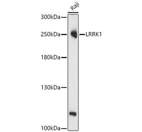 Western Blot - Anti-LRRK1 Antibody (A329577) - Antibodies.com