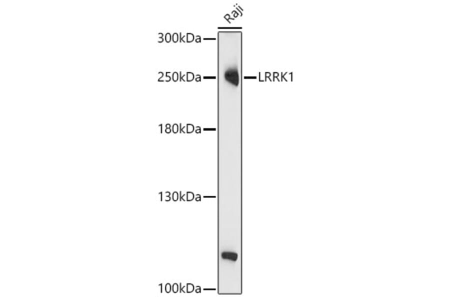 Western Blot - Anti-LRRK1 Antibody (A329577) - Antibodies.com