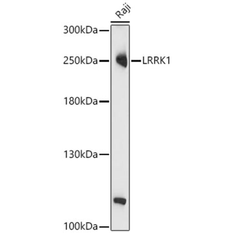 Western Blot - Anti-LRRK1 Antibody (A329577) - Antibodies.com