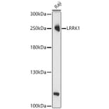 Western Blot - Anti-LRRK1 Antibody (A329577) - Antibodies.com