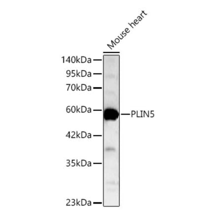 Western Blot - Anti-LSDP5 Antibody (A329578) - Antibodies.com