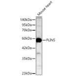 Western Blot - Anti-LSDP5 Antibody (A329578) - Antibodies.com