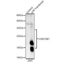 Western Blot - Anti-Luteinizing Hormone beta Antibody (A329581) - Antibodies.com