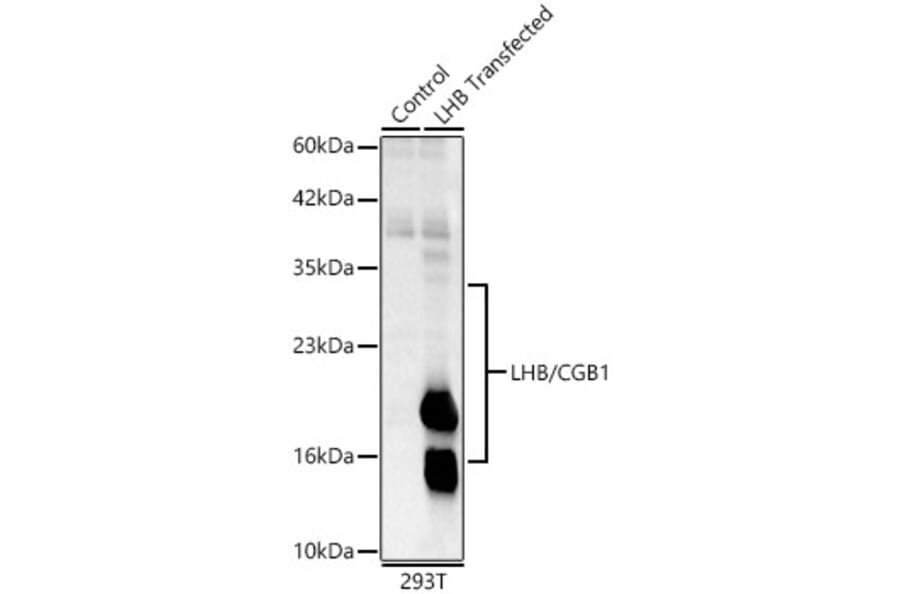 Western Blot - Anti-Luteinizing Hormone beta Antibody (A329581) - Antibodies.com