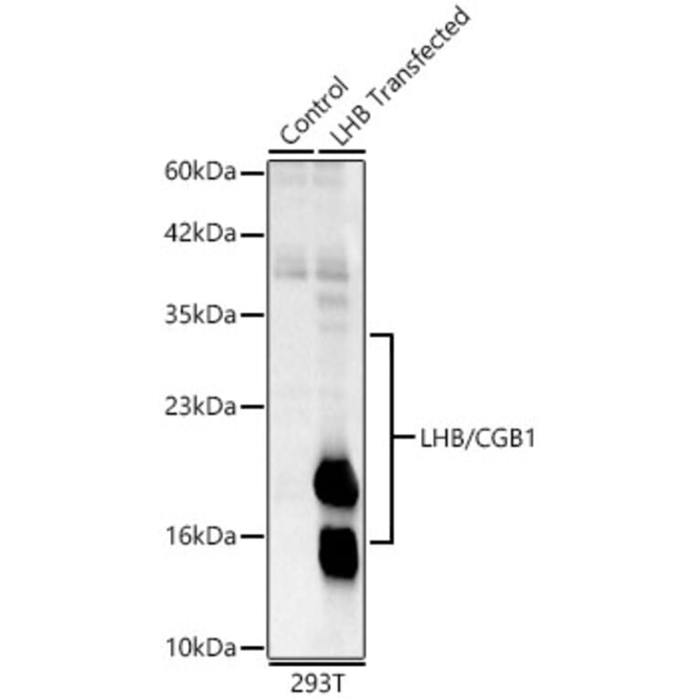 Western Blot - Anti-Luteinizing Hormone beta Antibody (A329581) - Antibodies.com