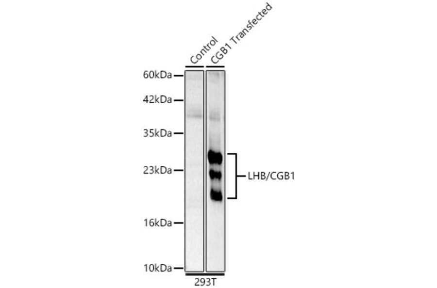 Western Blot - Anti-Luteinizing Hormone beta Antibody (A329581) - Antibodies.com