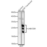 Western Blot - Anti-Luteinizing Hormone beta Antibody (A329581) - Antibodies.com