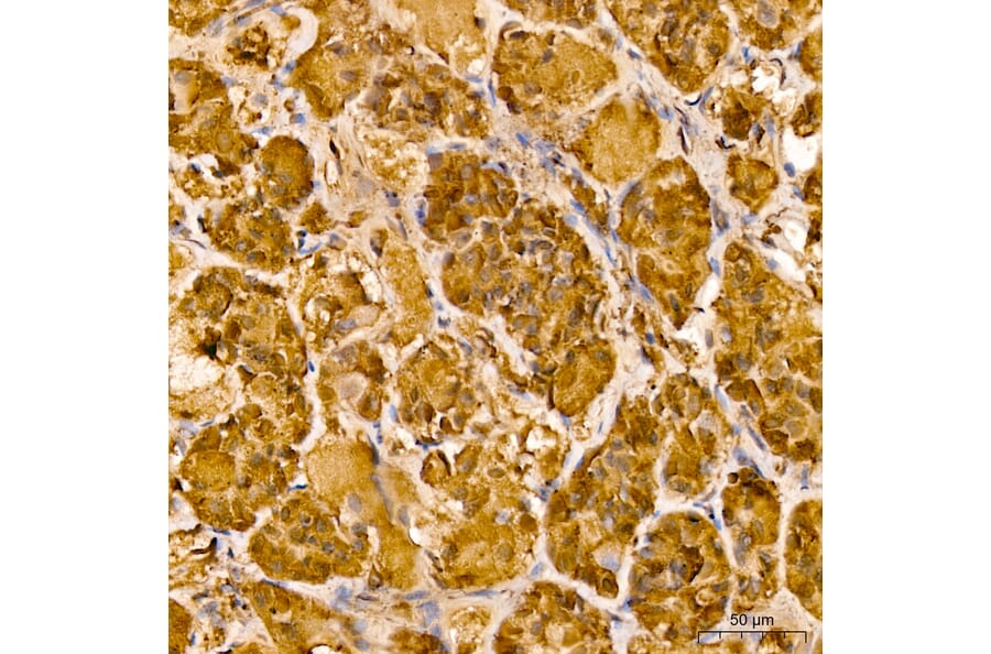 Immunohistochemistry - Anti-Luteinizing Hormone beta Antibody (A329581) - Antibodies.com