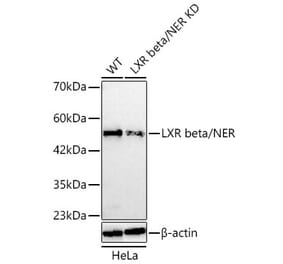 Western Blot - Anti-LXR beta Antibody (A329582) - Antibodies.com