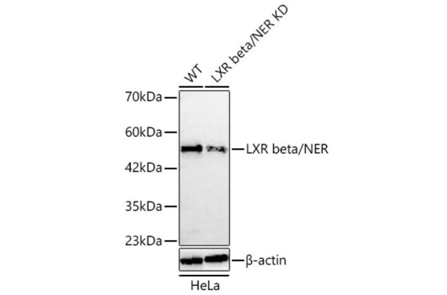 Western Blot - Anti-LXR beta Antibody (A329582) - Antibodies.com