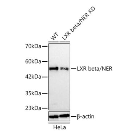 Western Blot - Anti-LXR beta Antibody (A329582) - Antibodies.com