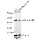 Western Blot - Anti-LXR beta Antibody (A329582) - Antibodies.com