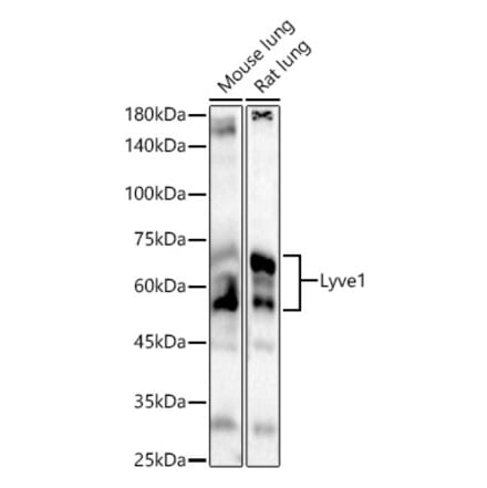 Western Blot - Anti-LYVE1 Antibody (A329584) - Antibodies.com