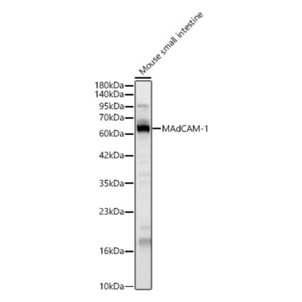 Western Blot - Anti-MAdCAM1 Antibody (A329586) - Antibodies.com