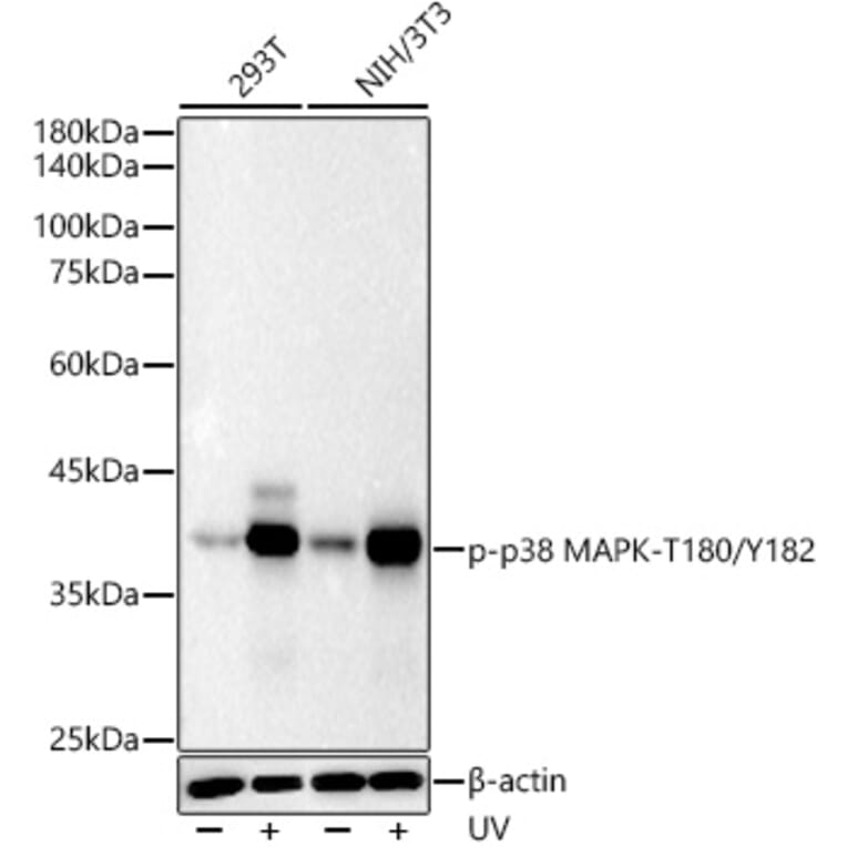 Western Blot - Anti-MAPK11 (Phospho T180/Y182) Antibody [ARC51023] (A329588) - Antibodies.com