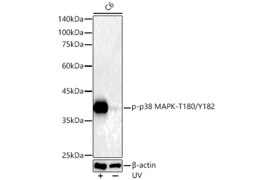Western Blot - Anti-MAPK11 (Phospho T180/Y182) Antibody [ARC51023] (A329588) - Antibodies.com