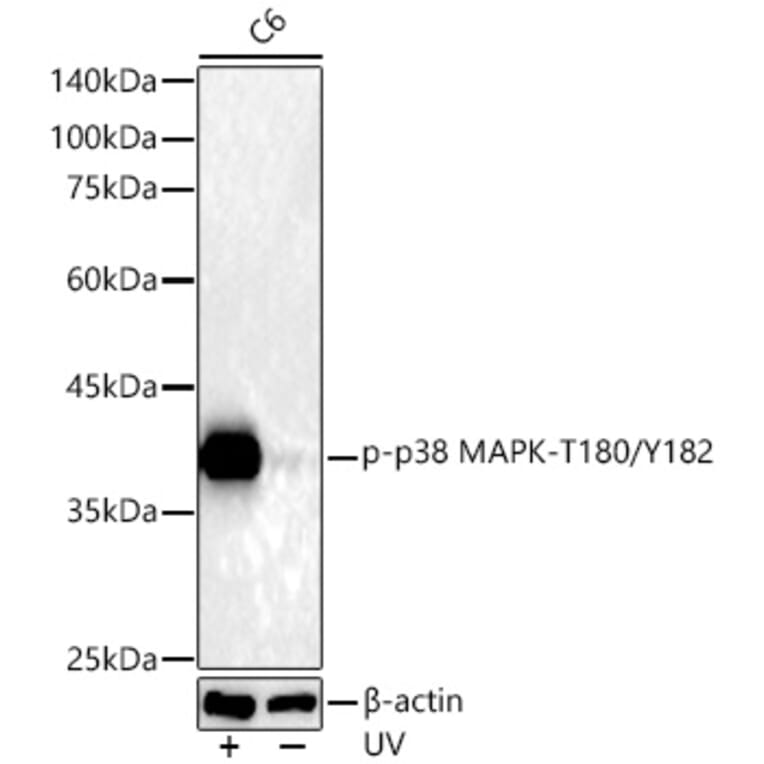Western Blot - Anti-MAPK11 (Phospho T180/Y182) Antibody [ARC51023] (A329588) - Antibodies.com