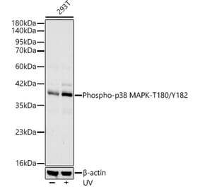Western Blot - Anti-MAPK11 (Phospho T180/Y182) Antibody [ARC62666] (A329589) - Antibodies.com