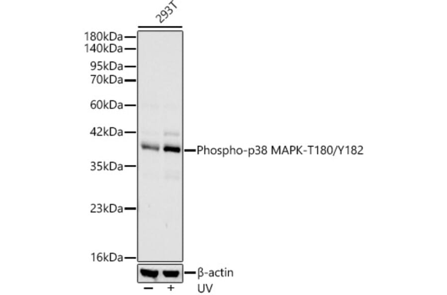 Western Blot - Anti-MAPK11 (Phospho T180/Y182) Antibody [ARC62666] (A329589) - Antibodies.com