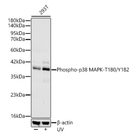 Western Blot - Anti-MAPK11 (Phospho T180/Y182) Antibody [ARC62666] (A329589) - Antibodies.com