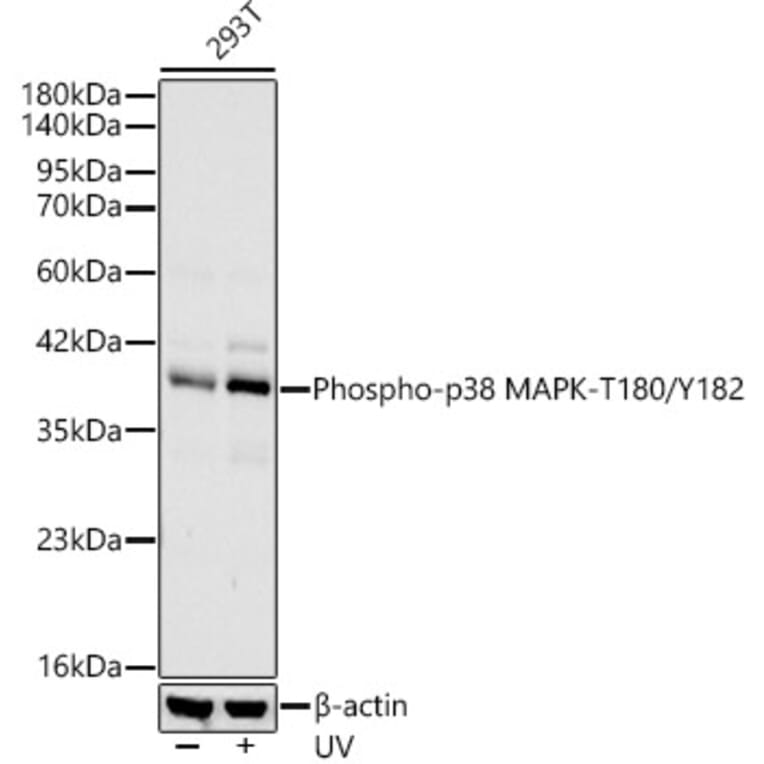 Western Blot - Anti-MAPK11 (Phospho T180/Y182) Antibody [ARC62666] (A329589) - Antibodies.com