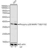 Western Blot - Anti-MAPK11 (Phospho T180/Y182) Antibody [ARC62666] (A329589) - Antibodies.com