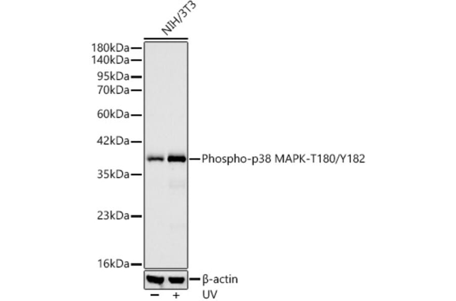 Western Blot - Anti-MAPK11 (Phospho T180/Y182) Antibody [ARC62666] (A329589) - Antibodies.com