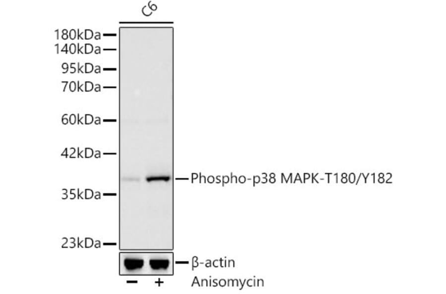 Western Blot - Anti-MAPK11 (Phospho T180/Y182) Antibody [ARC62666] (A329589) - Antibodies.com