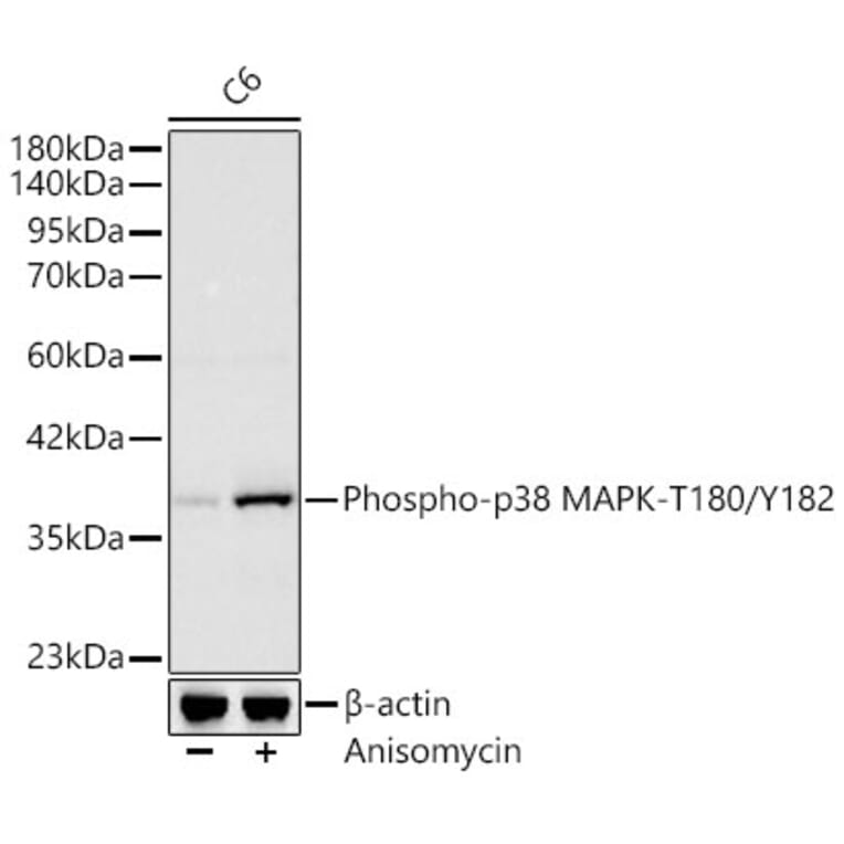 Western Blot - Anti-MAPK11 (Phospho T180/Y182) Antibody [ARC62666] (A329589) - Antibodies.com