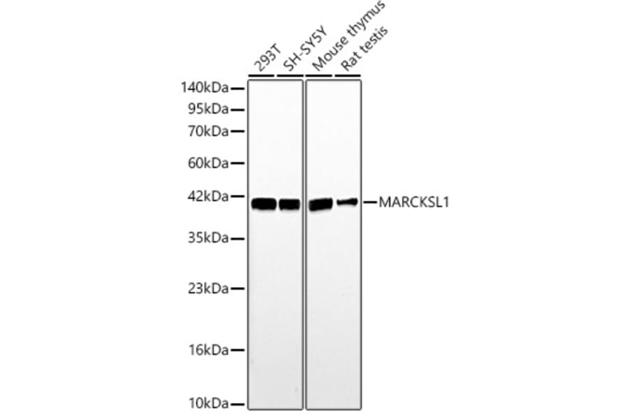 Western Blot - Anti-MARCKSL1 Antibody (A329590) - Antibodies.com