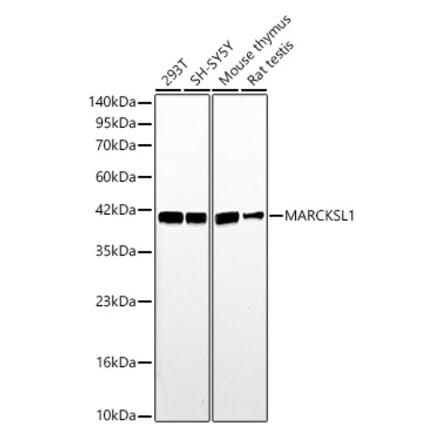 Western Blot - Anti-MARCKSL1 Antibody (A329590) - Antibodies.com