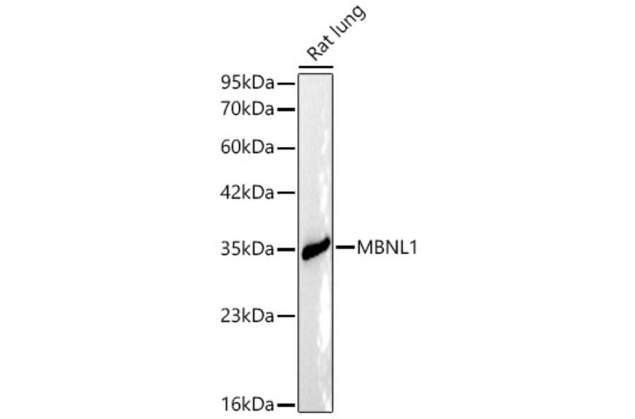 Western Blot - Anti-MBNL1 Antibody (A329591) - Antibodies.com