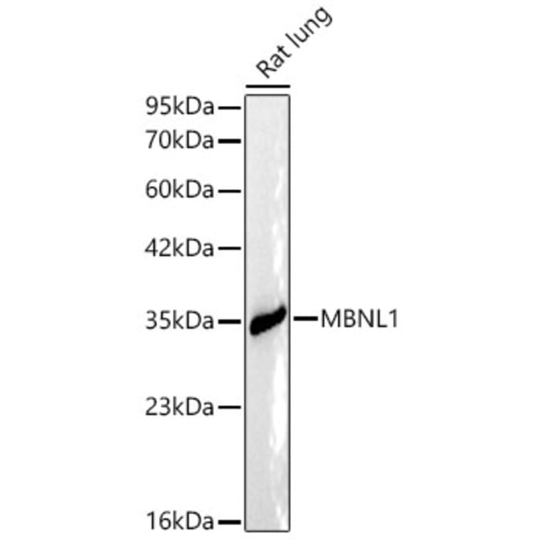 Western Blot - Anti-MBNL1 Antibody (A329591) - Antibodies.com