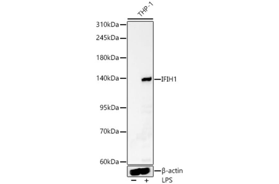Western Blot - Anti-MDA5 Antibody (A329597) - Antibodies.com