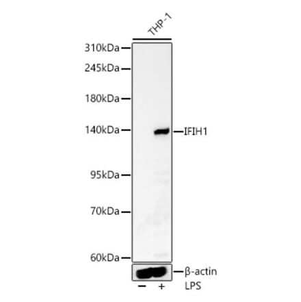 Western Blot - Anti-MDA5 Antibody (A329597) - Antibodies.com