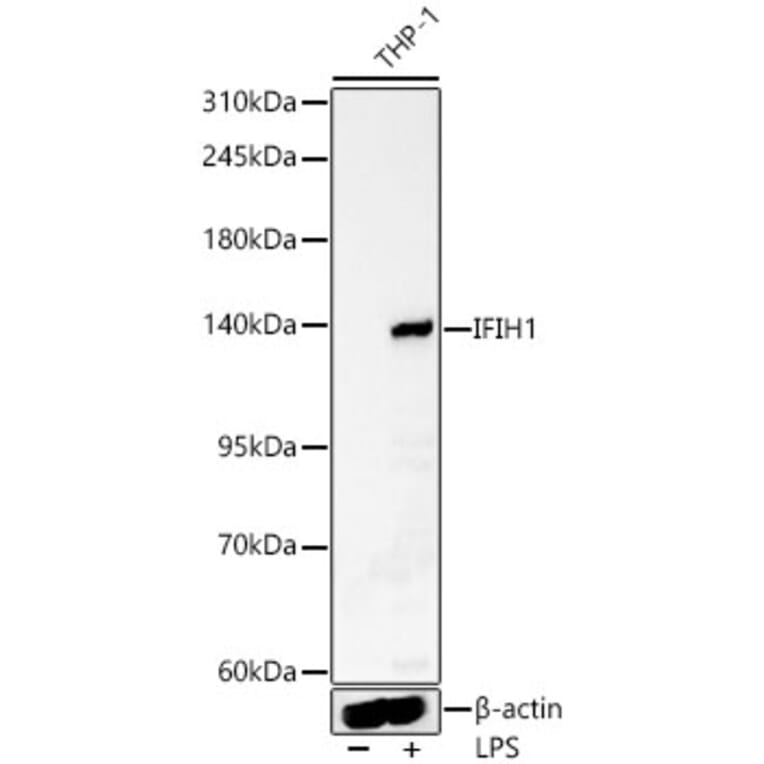 Western Blot - Anti-MDA5 Antibody (A329597) - Antibodies.com