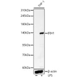 Western Blot - Anti-MDA5 Antibody (A329597) - Antibodies.com