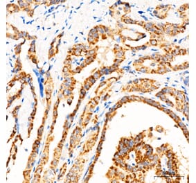 Immunohistochemistry - Anti-MECR Antibody (A329598) - Antibodies.com