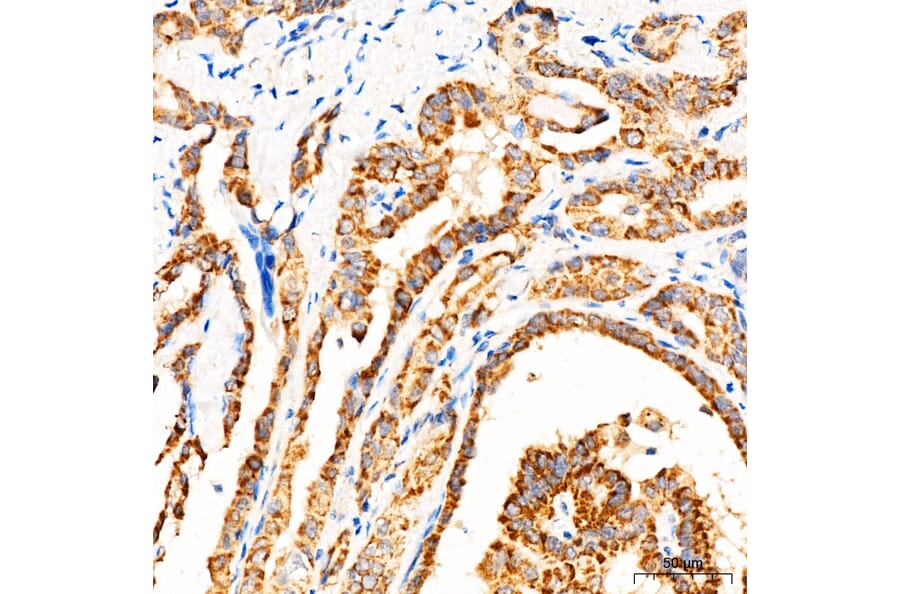 Immunohistochemistry - Anti-MECR Antibody (A329598) - Antibodies.com