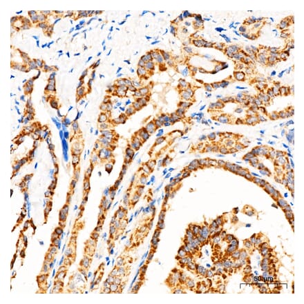 Immunohistochemistry - Anti-MECR Antibody (A329598) - Antibodies.com