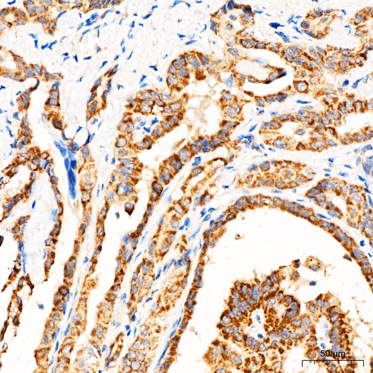 Immunohistochemistry - Anti-MECR Antibody (A329598) - Antibodies.com
