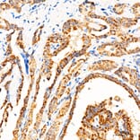 Immunohistochemistry - Anti-MECR Antibody (A329598) - Antibodies.com