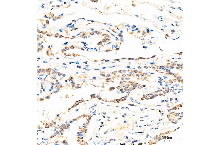 Immunohistochemistry - Anti-MECR Antibody (A329598) - Antibodies.com