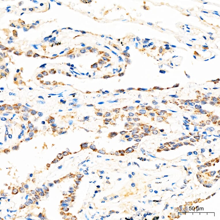Immunohistochemistry - Anti-MECR Antibody (A329598) - Antibodies.com