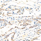 Immunohistochemistry - Anti-MECR Antibody (A329598) - Antibodies.com