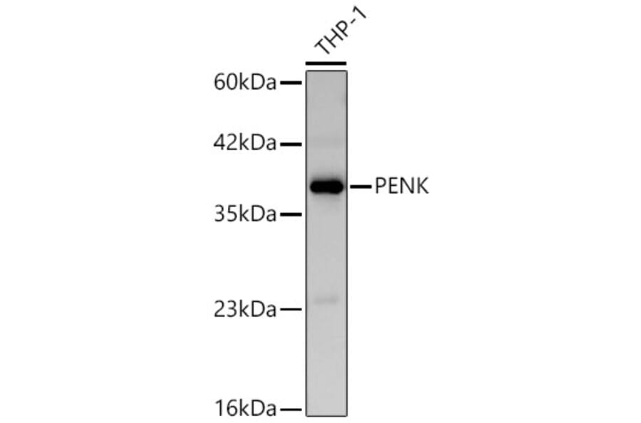 Western Blot - Anti-Met Enkephalin Antibody (A329599) - Antibodies.com
